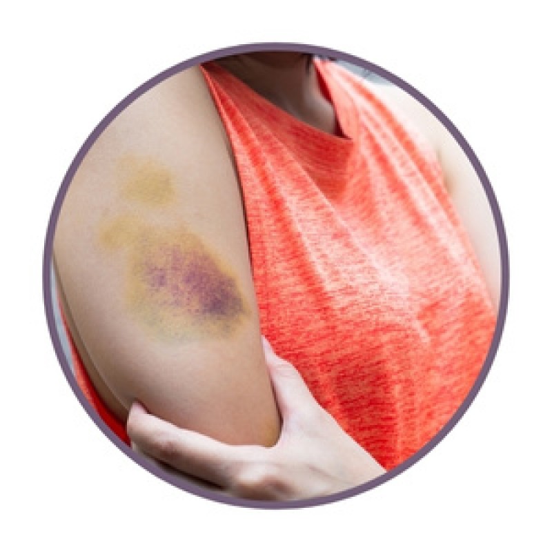 Мехлеми с билки за синини