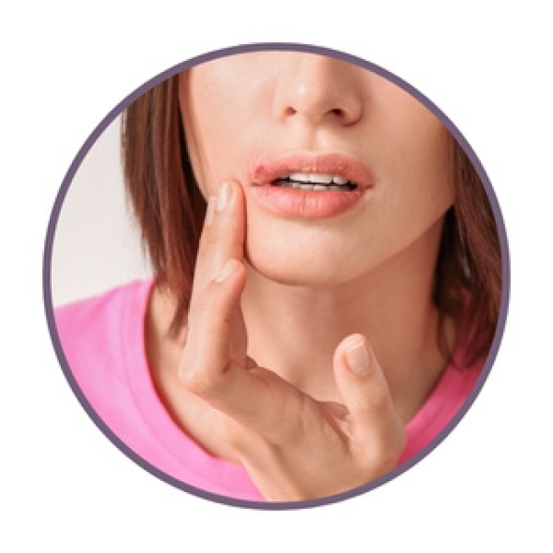 Мехлеми с билки за херпеси