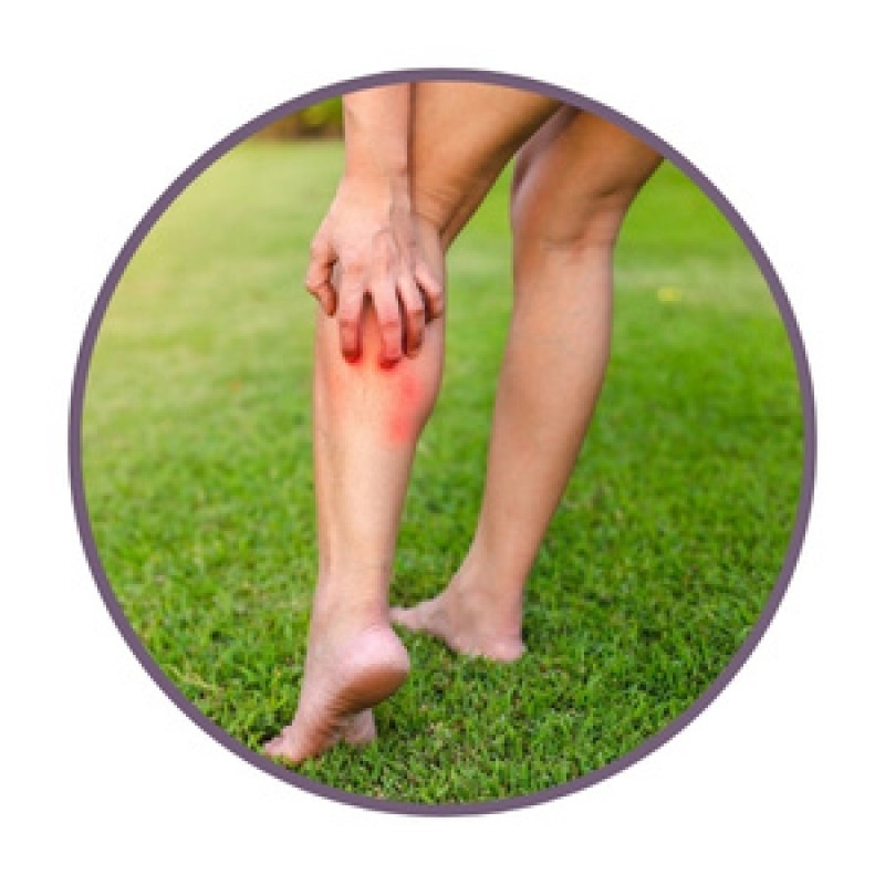 Мехлеми с билки за кожни обриви и възпаления