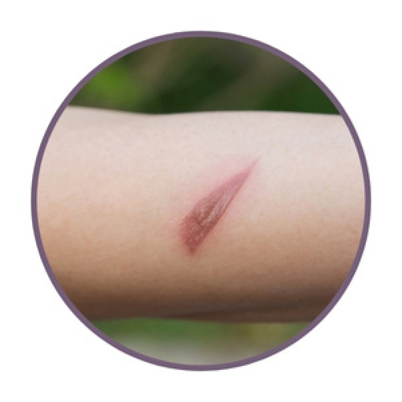 Мехлеми с билки за рани