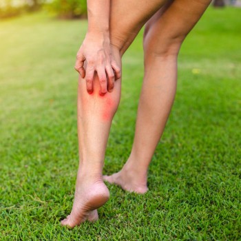 Ухапвания от насекоми