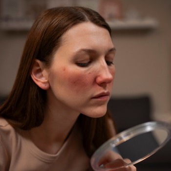 Зачервяване